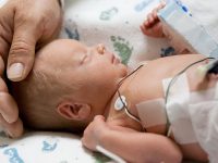 Naissance Prématurée