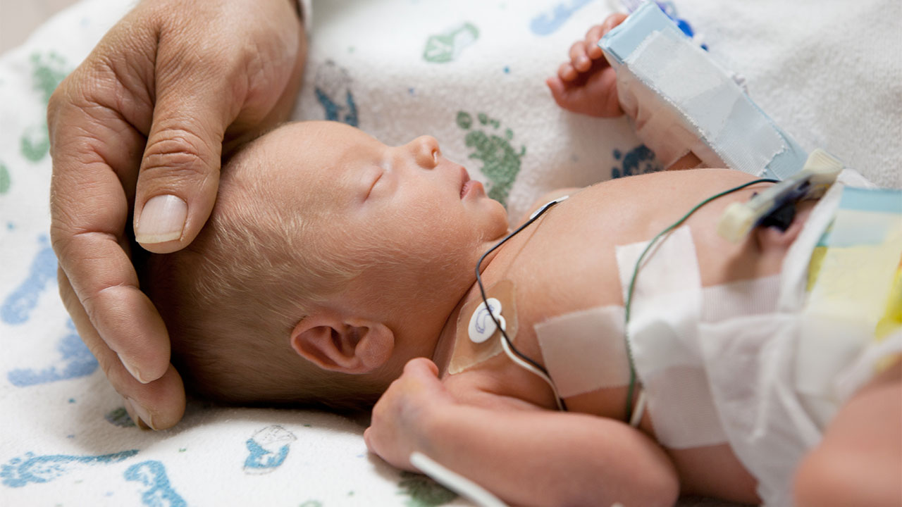 Naissance Prématurée